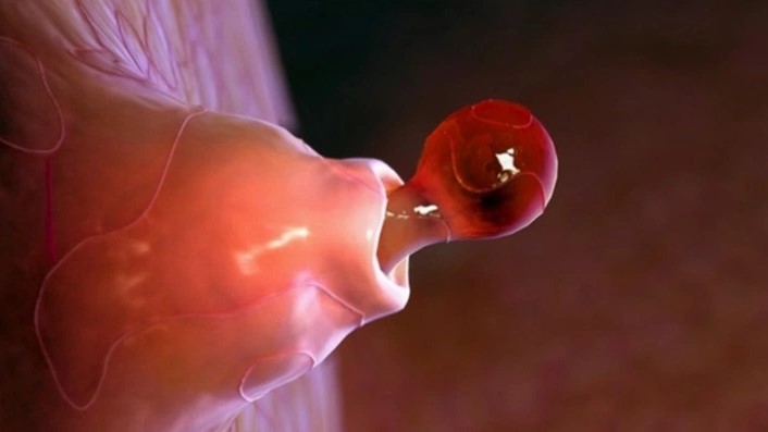 Phóng noãn là gì? Cách xác định, triệu chứng và cách xử lý khi phóng noãn 1