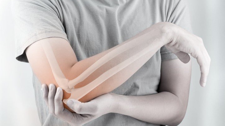 Phục hồi chức năng gãy thân xương cánh tay như thế nào? 1