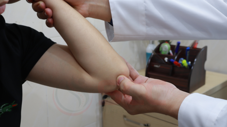 Phục hồi chức năng gãy thân xương cánh tay như thế nào? 2