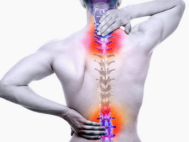 Phương pháp tiêm ngoài màng cứng chữa thoát vị đĩa đệm 2