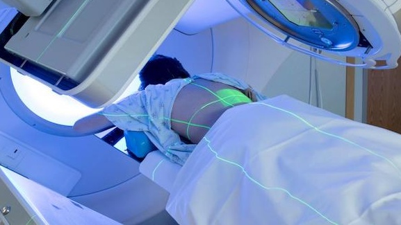 Phương pháp xạ trị trong chọn lọc có ưu điểm gì? 2