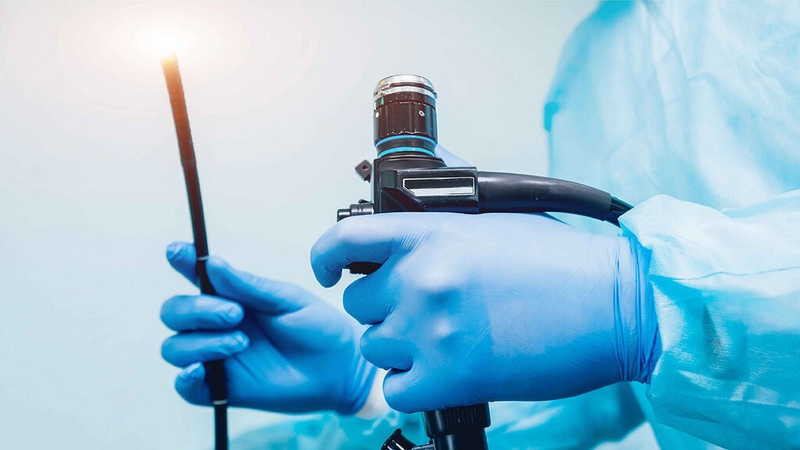Polyp đại tràng sigma 5mm có thể được cân nhắc cắt bỏ trong quá trình nội soi