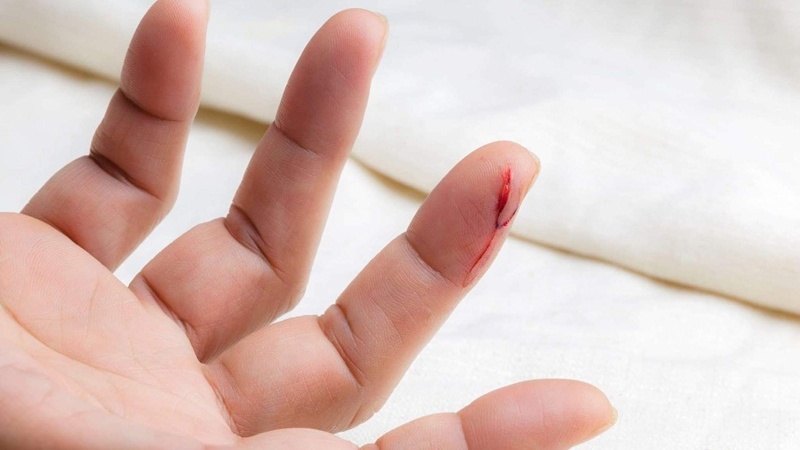 pt-la-gi-chi-so-nay-co-y-nghia-nhu-the-nao-doi-voi-nguoi-bi-roi-loan-dong-mau 1