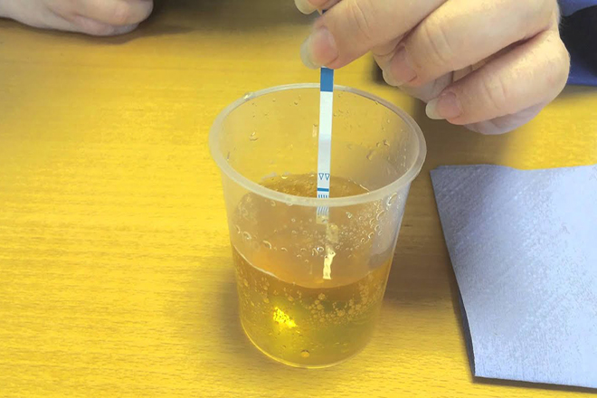 que-thu-thai-2-vach-mo-co-thai-khong-2 2