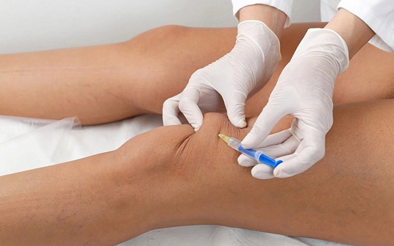 quy-trinh-thuc-hien-hut-dich-khop-goi 3.jpg