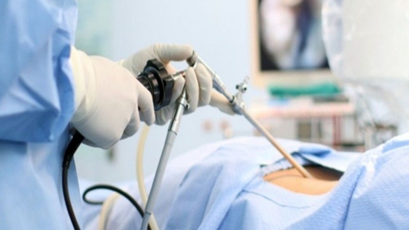 Quy trình thực hiện nội soi ổ bụng 1