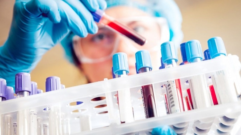 Quy trình thực hiện xét nghiệm hồng cầu lưới 1