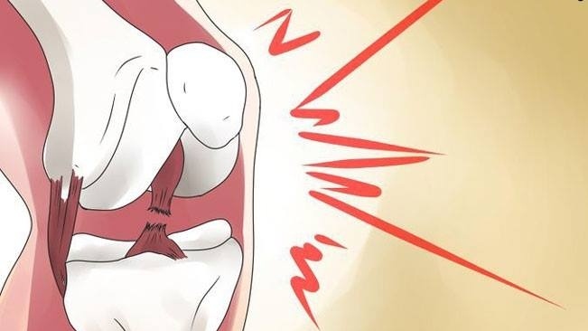 Rách dây chằng là do đâu và dấu hiệu nhận biết thế nào? 1