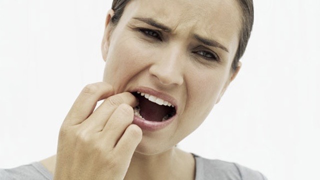 rang-bi-dat-thuc-an-nen-lam-gi-de-bao-ve-suc-khoe-rang-mieng 1