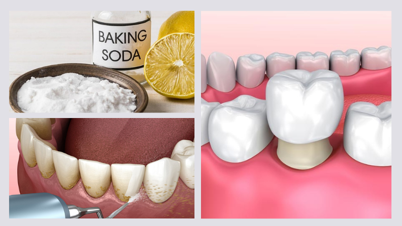 Răng bị đen trên bề mặt: Nguyên nhân, hệ lụy và cách can thiệp 4