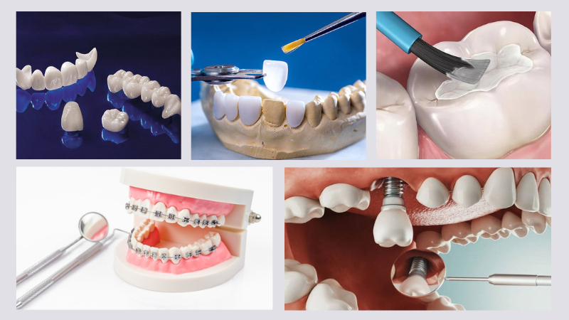Răng dị dạng: Khái niệm, phân loại và cách can thiệp 3