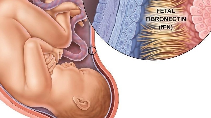 Rỉ ối là gì? Siêu âm có phát hiện rỉ ối không? 1