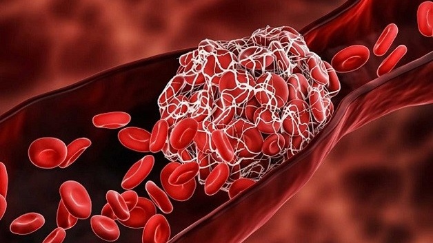 Ridlor 75mg là thuốc gì? Những điều cần lưu ý khi sử dụng 2