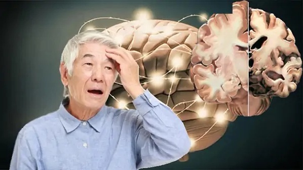 Rối loạn giấc ngủ là dấu hiệu báo trước bệnh Alzheimer? 1