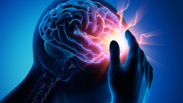 rối loạn thần kinh não 1