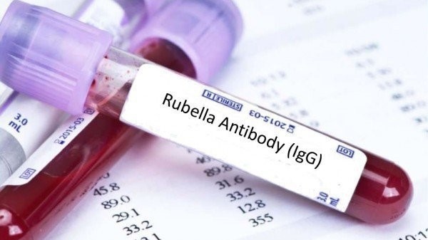 Rubella igG dương tính có ý nghĩa như thế nào? 4
