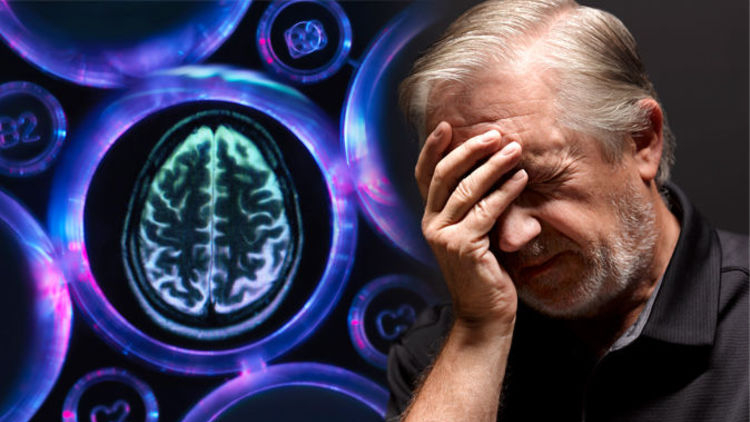 Sa sút trí tuệ trán - thái dương là gì?