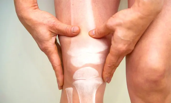 Sarcoma là gì? Bệnh có hiếm gặp không? 1