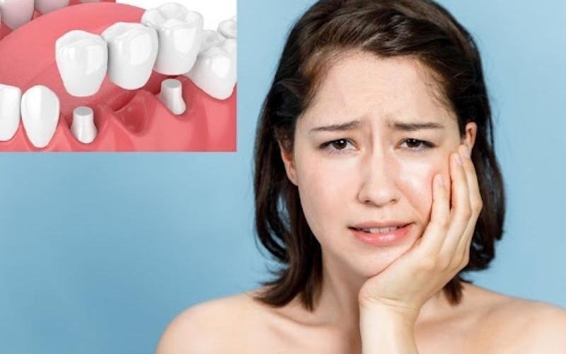 sau-khi-nho-rang-so-6-co-bi-hop-ma-khong 3.jpg