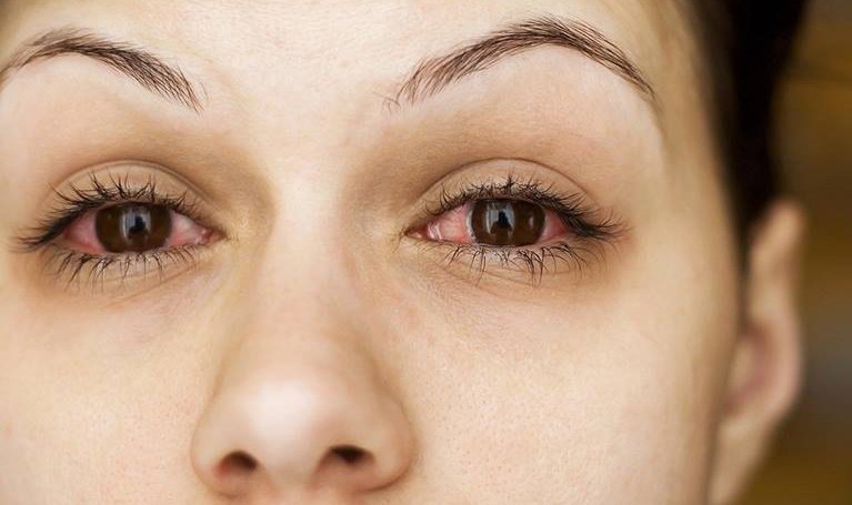 sau-khi-thuc-hien-phau-thuat-cat-mi-kieng-ruou-bia-bao-lau 3.jpg