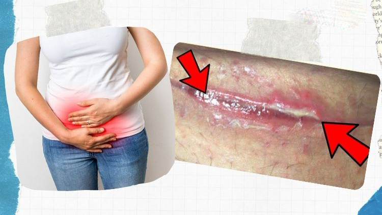 Sau sinh ăn thịt mỡ được không? Những lưu ý quan trọng về dinh dưỡng sau sinh  2