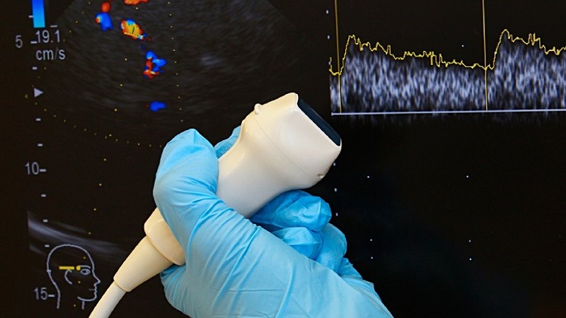 Siêu âm doppler xuyên sọ được chỉ định trong trường hợp nào? 3