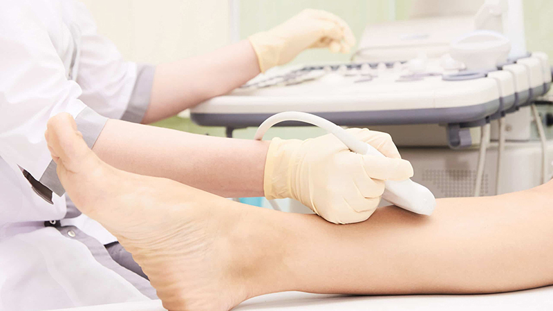 Siêu âm mạch máu chi dưới để làm gì? Khi nào cần siêu âm mạch máu chi dưới? 1