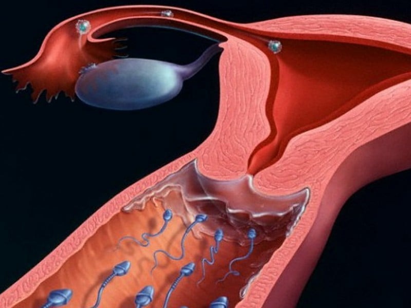 Siêu âm nội mạc tử cung dày 14mm có thai hay không? 3