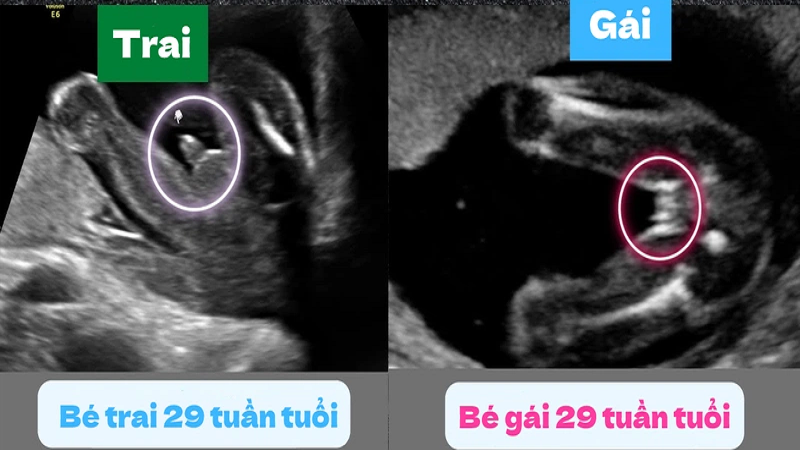 Những điều cần biết về liên giới tính ở trẻ 2