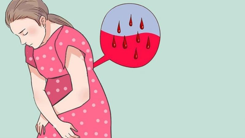 Sinh mổ lần 2 có chờ chuyển dạ? 3