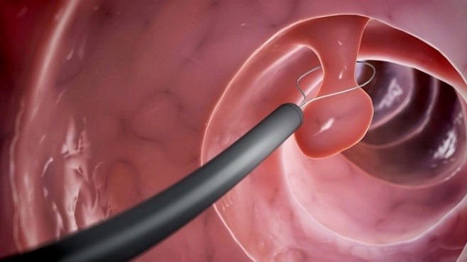 sinh-thiet-dai-trang-la-gi-ung-dung-cua-ky-thuat-sinh-thiet-dai-trang 1