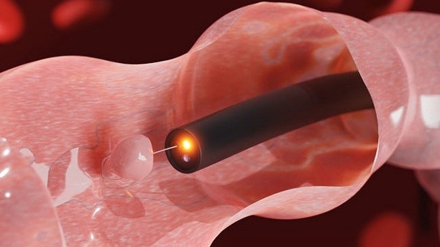 sinh-thiet-dai-trang-la-gi-ung-dung-cua-ky-thuat-sinh-thiet-dai-trang 2