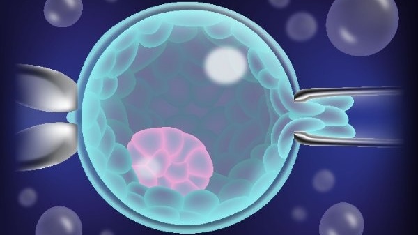 Sinh thiết phôi là gì? Chi phí sinh thiết phôi vào khoảng bao nhiêu? 1