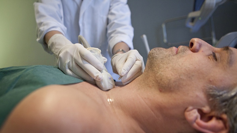 Khi nào cần sinh thiết tuyến giáp? Sinh thiết tuyến giáp bao lâu có kết quả? 2