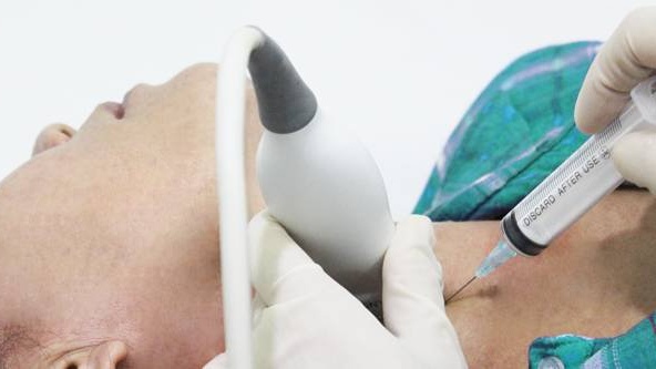 Khi nào cần sinh thiết tuyến giáp? Sinh thiết tuyến giáp bao lâu có kết quả? 3