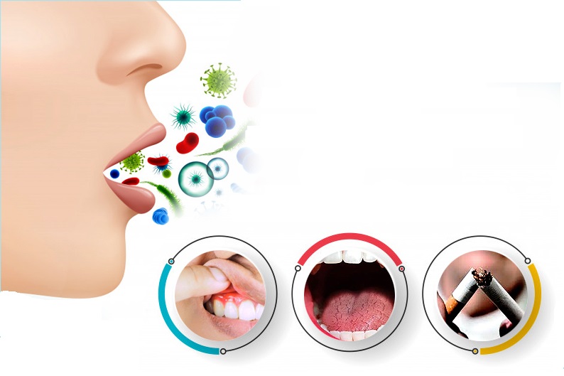 Vì sao ngủ dậy bị chua miệng và cách khắc phục? 2