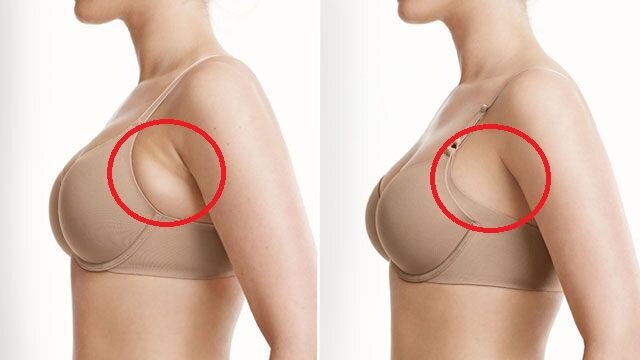 an-gi-de-giam-mo-nach-nhanh-chong-va-hieu-qua 1.jpg