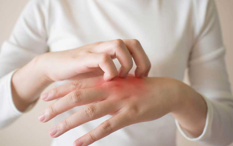 Chạy thận có mệt không? Những vấn đề thường gặp khi chạy thận nhân tạo 3