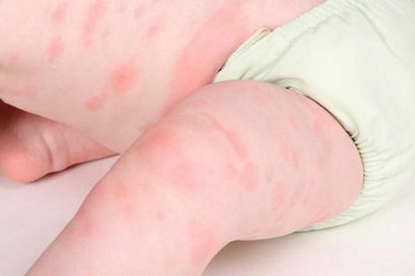 be-6-thang-tiem-mui-gi-de-con-khoe-manh-va-duoc-bao-ve-toan-dien 3.jpg