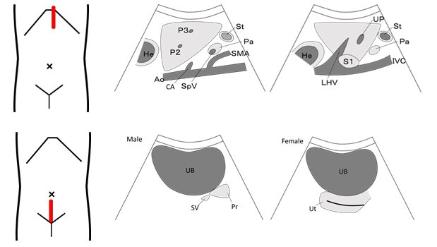 Các mặt cắt cơ bản trong siêu âm bụng 01
