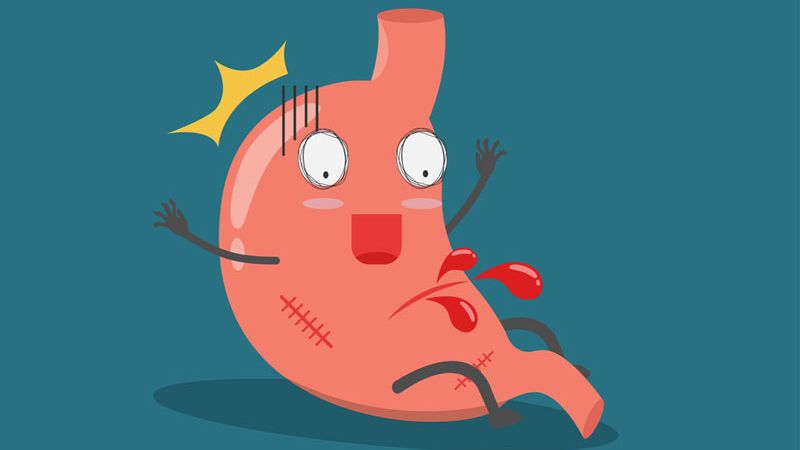 Cách xử trí cầm máu xuất huyết tiêu hóa 1