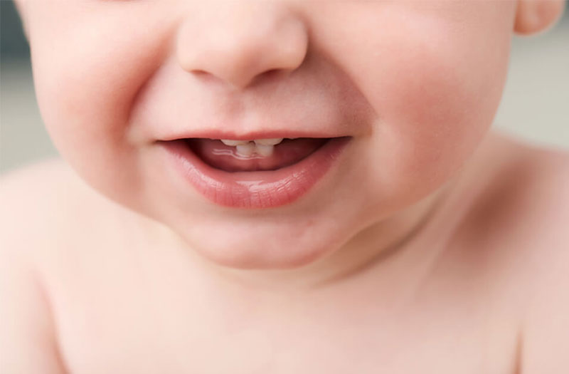 {HỎI ĐÁP} Bé chậm mọc răng có phải thiếu canxi? 3