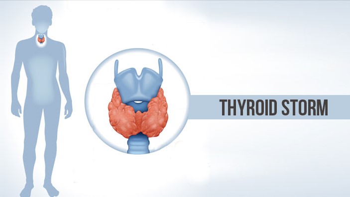 Cơn bão giáp là gì? Triệu chứng và biến chứng của bão giáp như thế nào? 1