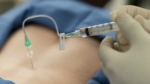 dau-bung-de-nhu-the-nao-thi-di-benh-vien 4