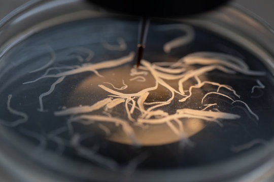 dau-hieu-benh-nhan-nhiem-san-xo-mit 1.jpg