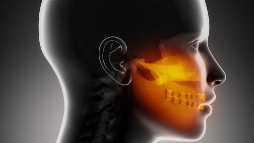 Hình ảnh ung thư xương quai hàm: Hiểu rõ bệnh để điều trị sớm 3