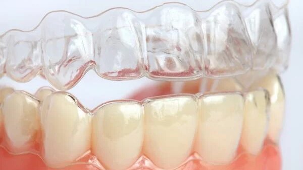 Hàm duy trì trong suốt có tác dụng gì? 1