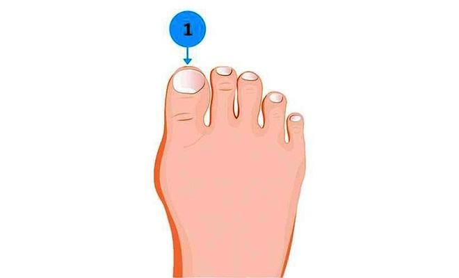 Kể tên các ngón chân và đặc điểm của chúng 1