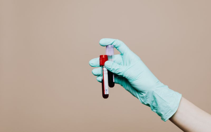 Xét nghiệm máu có thể được chỉ định khi khám thai, vì vậy mẹ bầu nên nhịn ăn sáng để xét nghiệm cho kết quả chính xác nhất