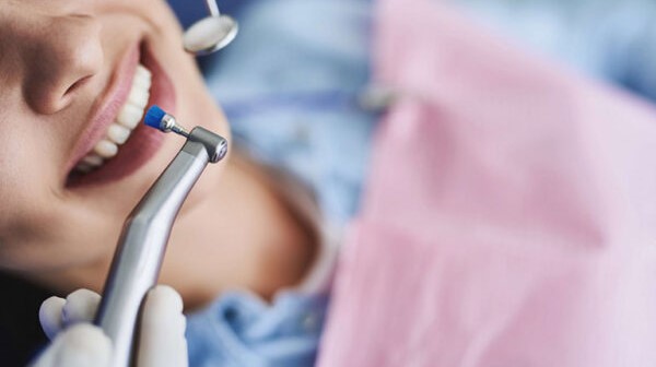 Lấy cao răng bằng máy siêu âm: Ưu điểm, quy trình và những lưu ý cần biết 4